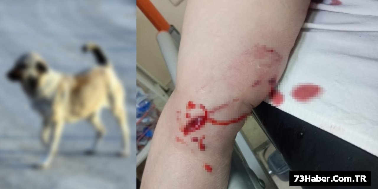 Şırnak'ta Sokak Köpekleri Saldırdı